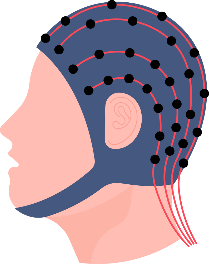 test head injury Sleep  bio feedback Stroke Cerebral palsy wave